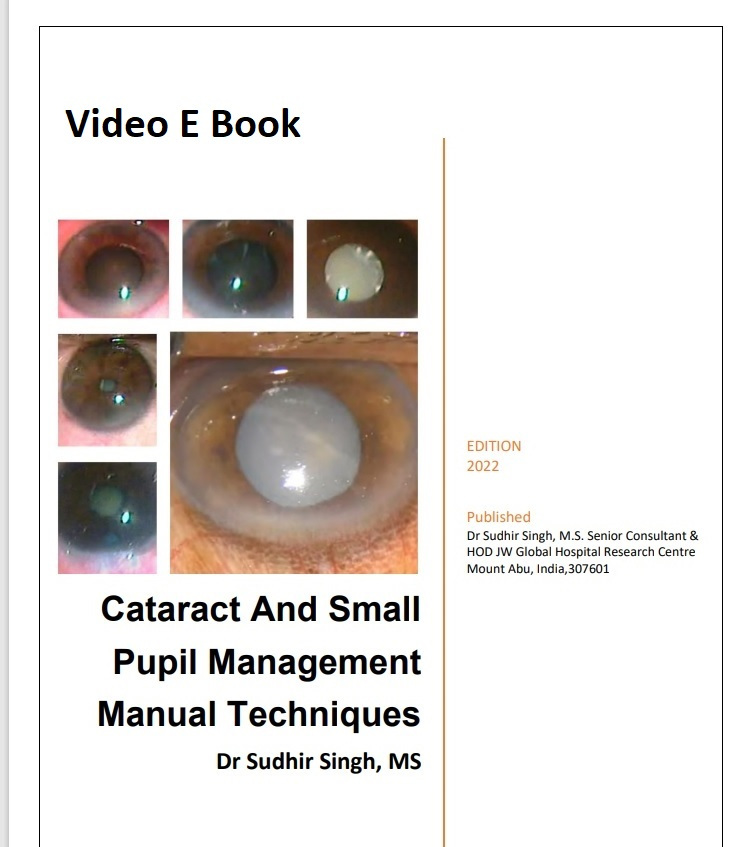 Cataract Small Pupil Management E Video Book Download